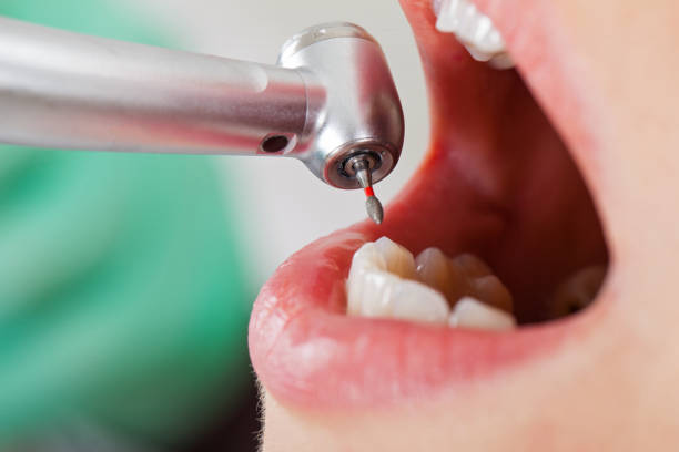 Best Emergency Dental Care for Broken or Chipped Teeth in Penbrook, PA